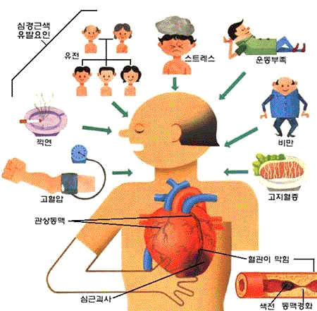 [김현일 원장의 한방칼럼]서구화된 생활습관이 유발하는 ..