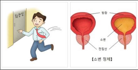 남성 건강의 신호등, ‘전립선암’ [한국건강관리협회 대..