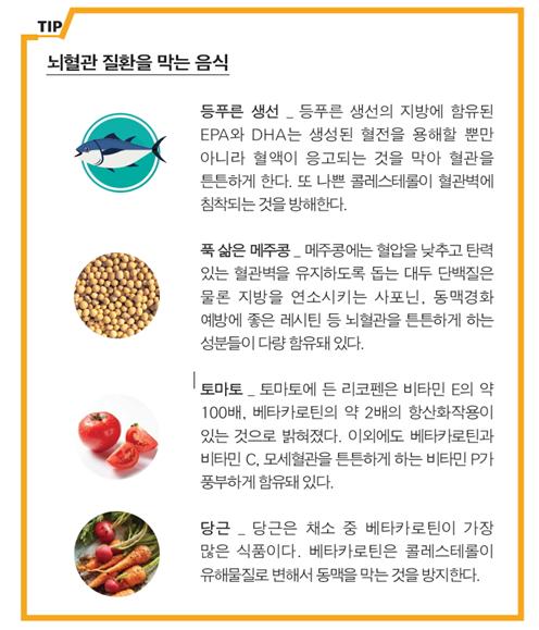 평화로운 일상 위협하는 ‘뇌혈관 질환’ [건강상식] 한..